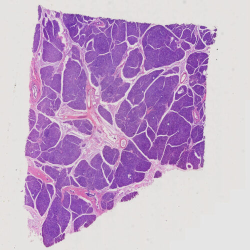 Human Pancreas show pancreatic islet